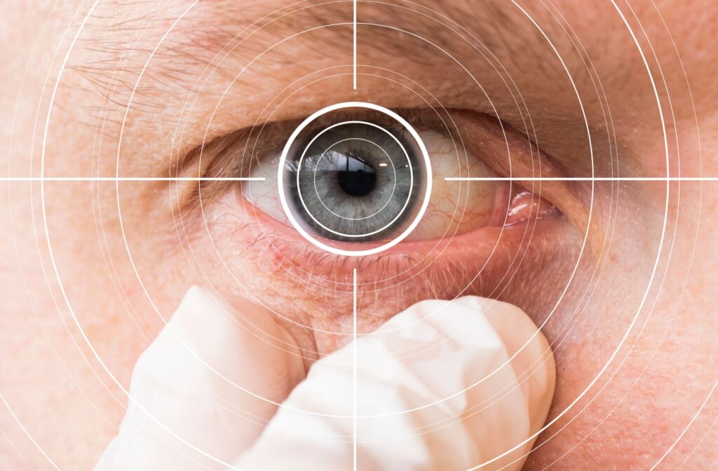 A close up of an eye with a digital target around it, symbolizing laser eye surgery.